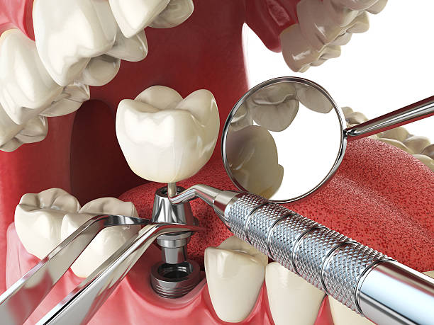 Best Emergency Dental Services for Seniors in Clinton, WA