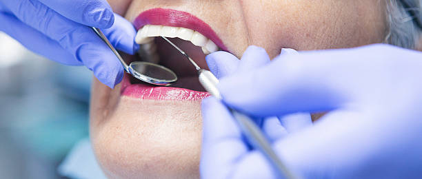Best Broken or Cracked Tooth Emergency Dentist in Clinton, WA